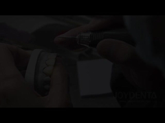 Las carillas de la langosta La solución perfecta para las carillas dentales translúcidas naturales