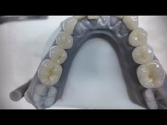 Dentaduras de zirconia que imitan los dientes naturales