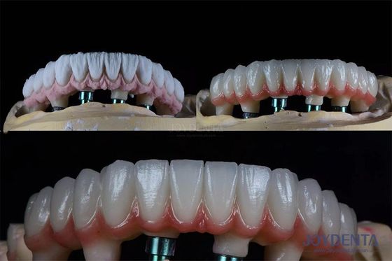 comprar 10 mm Dientes múltiples Kit de implantes dentales de dos etapas para corona protética endossea fabricación en línea