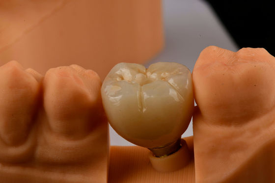 comprar Implantes dentales de un solo diente con conexión hexadecimal interna fabricación en línea