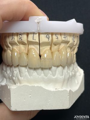 comprar Corona de metal fundido de porcelana sin costura PFM para restauración biocompatible a largo plazo fabricación en línea