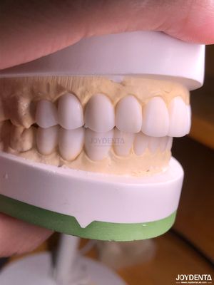 comprar Cera de diagnóstico digital personalizada para la replicación de la anatomía dental natural fabricación en línea