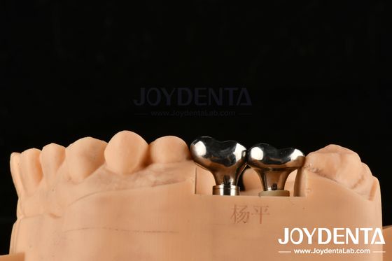comprar Abutments de implante dental de plata Diámetro personalizable Altura Tecnología CAD CAM fabricación en línea