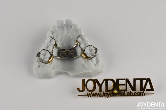 comprar Retenes ortodónticos ajustables para enderezar los dientes Salud oral fabricación en línea