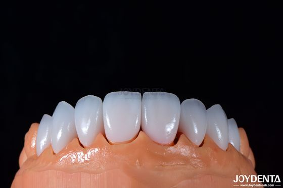 comprar 0.3-0.5 mm de espesor Emax carilla de porcelana para dentistería cosmética de alto brillo fabricación en línea