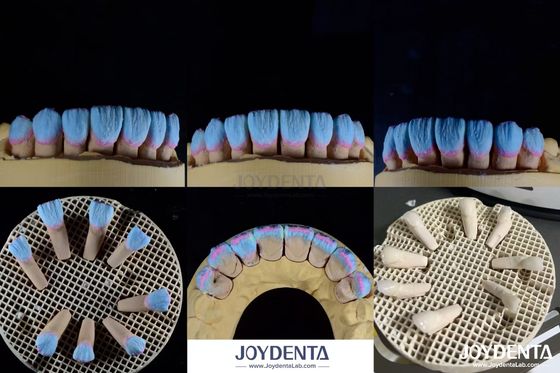comprar Alta biocompatibilidad Finilla de cerámica feldspática brillante para restauraciones dentales fabricación en línea