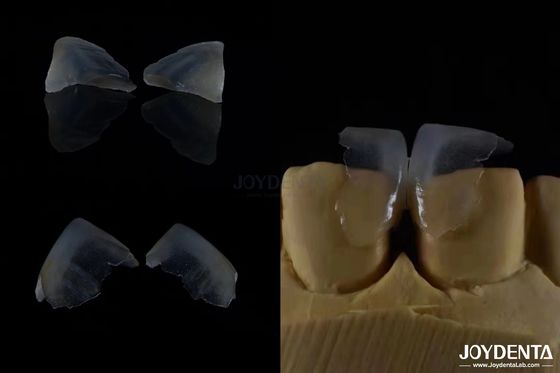 comprar Minimalmente invasivo Cosmético Veneers dentales de vidrio de color cerámico ultra delgado fabricación en línea
