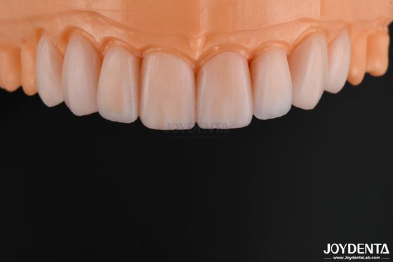 comprar Veneer de vidrio cerámico personalizable de aspecto natural y alta resistencia química fabricación en línea