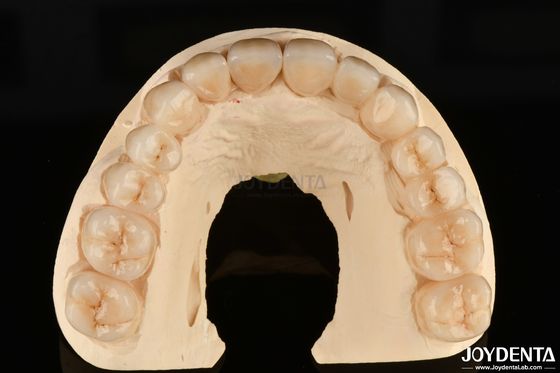 comprar Alta resistencia a la corrosión Zirconia completa El material preferido para restauraciones dentales blancas fabricación en línea