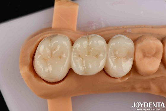 comprar Alta resistencia a la flexión Zirconia de contorno completo para coronas Puentes Restauración dental fabricación en línea