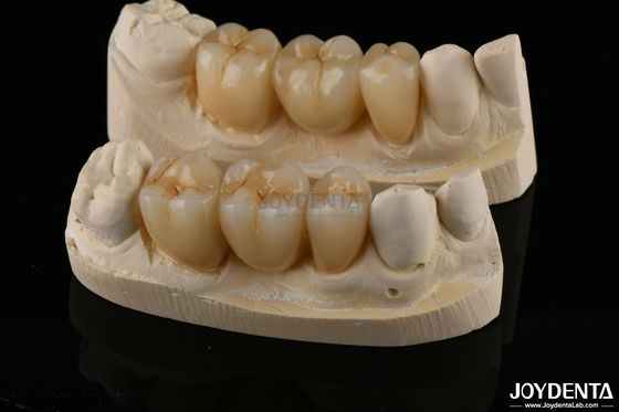 comprar Resistencia al desgaste Zirconia de contorno completo Corona dental de alta translucidez fabricación en línea