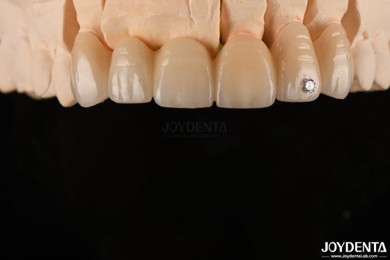 comprar CAD / CAM fresado de zirconia en capas dentales para coronas únicas 0,3-0,5 mm de espesor de capa fabricación en línea
