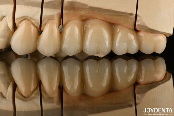 comprar Muchas capas de zirconio para restauraciones dentales Ultra translúcidas fabricación en línea
