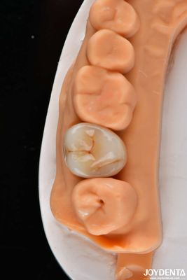 comprar Dental de múltiples capas de zirconia completa coronas y puentes de alta transparencia aspecto natural fabricación en línea