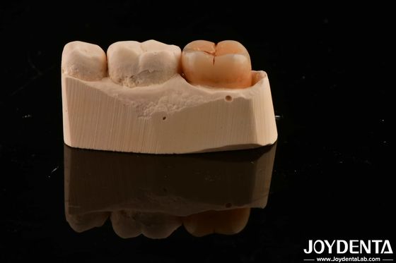 comprar Material de restauración dental de múltiples capas de zirconio completo 1200 HV dureza resistencia a las grietas fabricación en línea