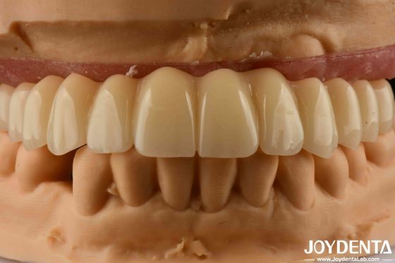 comprar Solución dental con base en Ti Circonio Puente híbrido Alta biocompatibilidad Aspecto natural fabricación en línea