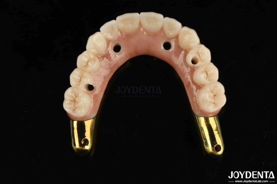 comprar Puente híbrido de zircónia resistente al desgaste con dientes y encías naturales compatibles con Ti-Bar fabricación en línea
