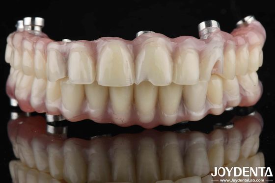 comprar Dentes de laboratorio de aspecto natural con acabado acrílico para alta resistencia al desgaste fabricación en línea