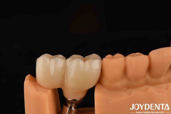 comprar Tipo de hilo en forma de V Abutments terminados Compatibilidad con todos los sistemas de implantes principales fabricación en línea