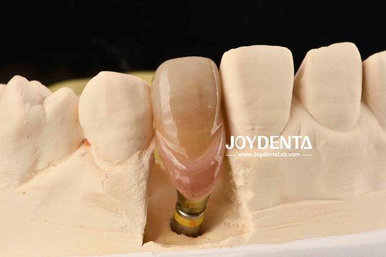 comprar 0° Angulación Abutamentos dentales terminados de 1,5 mm de hilo de tramo Superficie pulida fabricación en línea