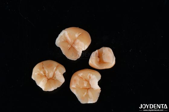 comprar Formas personalizables de incrustaciones y incrustaciones compuestas Resistencia a las manchas dentales Duradera fabricación en línea