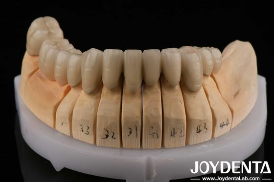comprar Porcelana PFM de aleación de oro fundida con metal dental compatible con la capa de porcelana fabricación en línea