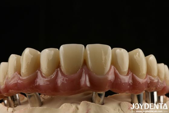 comprar Puente híbrido dental de titanio Malong de larga duración ajustado para ajustarse baja densidad fabricación en línea