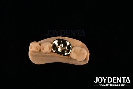 comprar FMC metálico de reparación clínica oral Materiales para implantes dentales resistentes a los abrasivos fabricación en línea