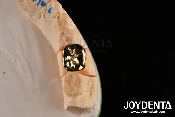comprar Resistencia a la abrasión Cera dental de fundición FMC Corona para la reparación clínica oral fabricación en línea