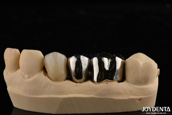 comprar Corona de aleación de metal resistente a la abrasión para restauraciones dentales personalizadas fabricación en línea