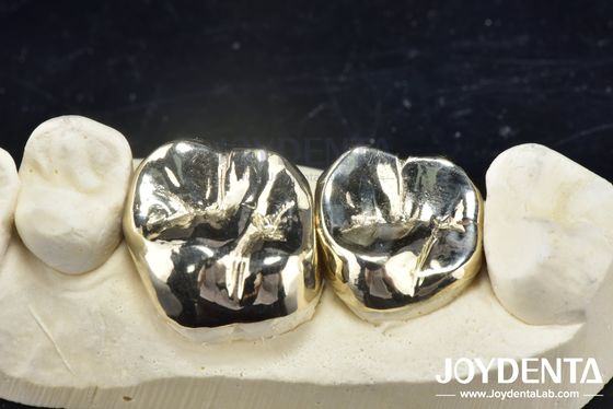 comprar Reparación dental de fundición de cera Corona de metal completo para rehabilitación oral resistente a la abrasión fabricación en línea