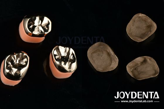comprar Restauración dental Coronas metálicas de oro para el tratamiento de rehabilitación oral fabricación en línea