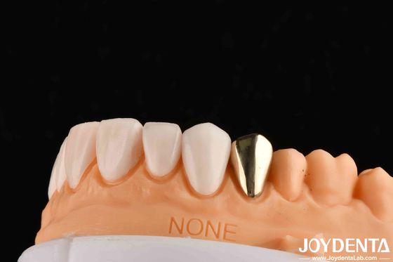 comprar Oro fundido de cera 60K Coronas dentales metálicas Coronas dentales de oro resistentes al abrasivo fabricación en línea