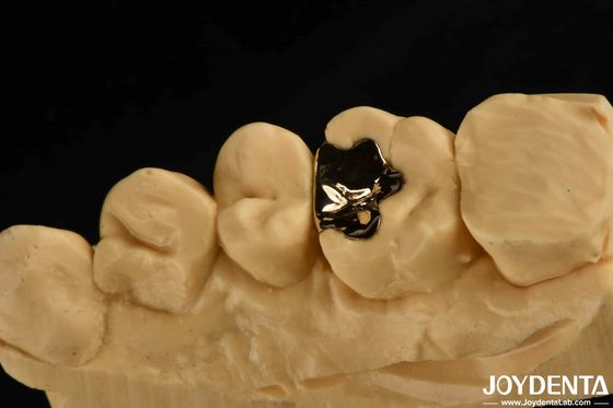 comprar Coroa de oro dental clínico metálico de 60K de oro de la tapa del diente para la rehabilitación oral fabricación en línea