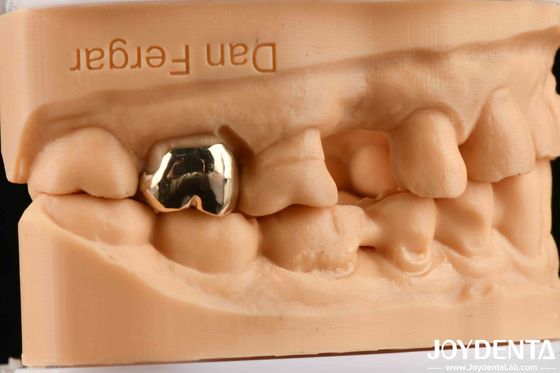 comprar Materiales dentales de fundición de cera resistente a la abrasión para mejorar la rehabilitación oral fabricación en línea