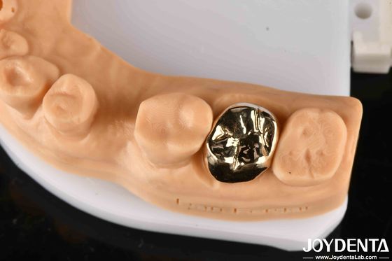 comprar Material metálico corona dental de oro, corona de dientes de oro para una rehabilitación oral óptima fabricación en línea