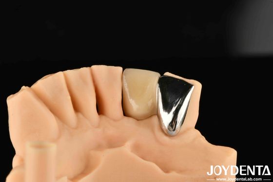 comprar Dental Metal / Maryland Bridege Oral Clinical Repair Metallic Color Ideal Enlace clínico fabricación en línea