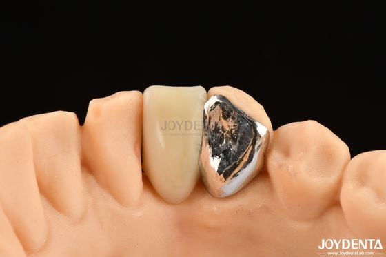 comprar Aplicación ideal de la unión clínica Maryland Dental para el trabajo de reparación clínica oral fabricación en línea