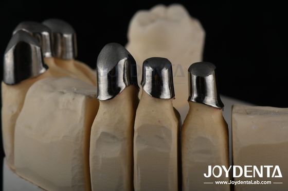 comprar Localizador de acero Apego dental, Apego de dentadura parcial de precisión Removible fabricación en línea