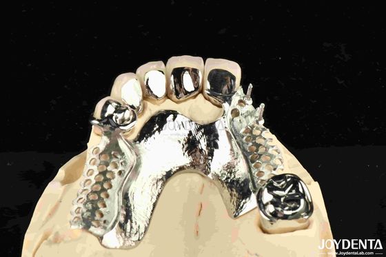 comprar Cuadro dental de aleación de metal extraíble portátil para dentistas fabricación en línea