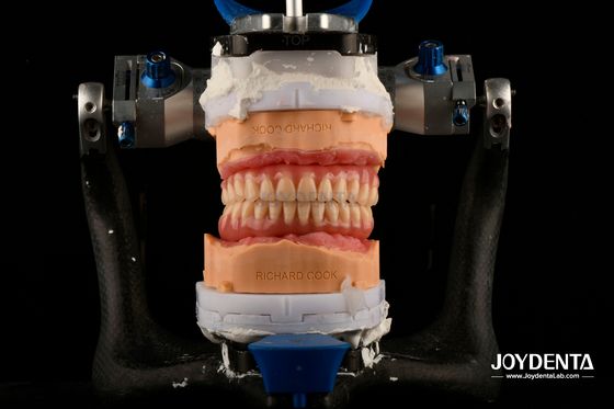 comprar Dentadura dental acrílica ligera, cómoda y adecuada, personalización profesional fabricación en línea