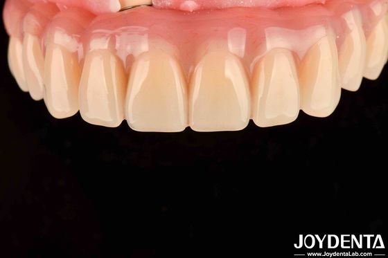 comprar Tratamiento dental Alta elasticidad Acrílico Dentes falsos Finish para el arreglo de los dientes fabricación en línea