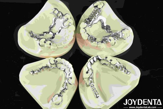 comprar Cuadro de metal dental de buena aptitud Material metálico para restauraciones dentales duraderas fabricación en línea