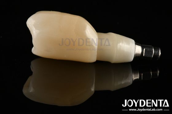 comprar Diseño de barras de implantes dentales de margen de hombro para necesidades de plataformas protésicas amplias fabricación en línea