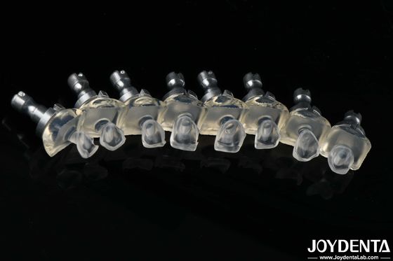 comprar Cristales de porcelana de alta transparencia carillas dentales de alta resistencia 0,3-0,8 mm de espesor fabricación en línea