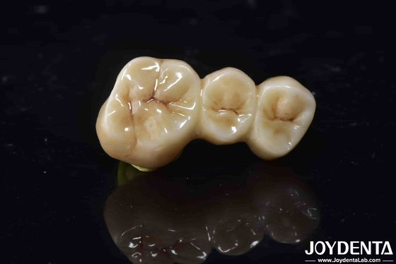 comprar Alta biocompatibilidad Coroa de contorno completo de zirconia perfecta Alta resistencia fabricación en línea