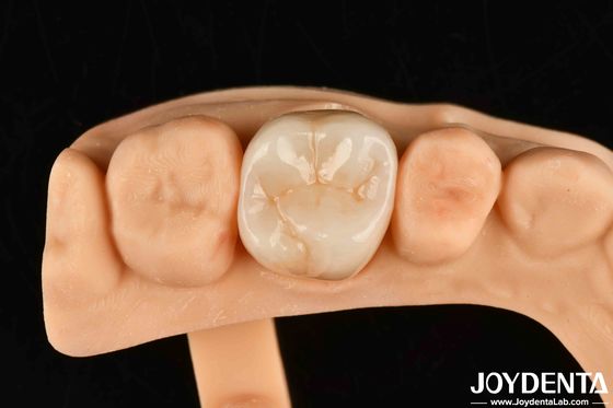 comprar Alta resistencia al desgaste Dental de zirconio completo Puente de zirconio de contorno completo fabricación en línea