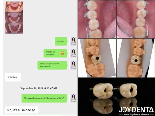 comprar Implantes dentales de arco completo de larga duración Longitud del implante endóseo 10 mm-16 mm fabricación en línea