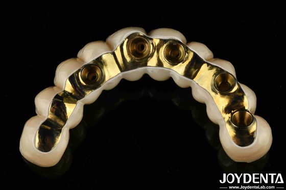 comprar Prótesis dental hecha a medida con puente híbrido de zirconia fabricación en línea