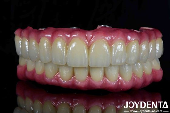 comprar Puente Híbrido de Titanio Dental de Malong ligero Confortable para la restauración dental fabricación en línea